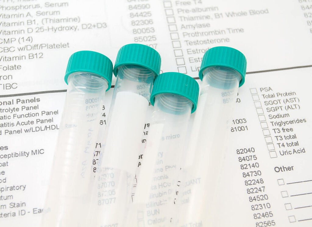 devon-rex-cats-fully-DNA-tested-sires-lab-test-tubes